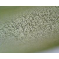 Ulva intestinalis