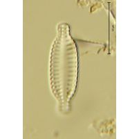 Achnanthes kolbei