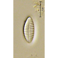 Achnanthidium subatomus
