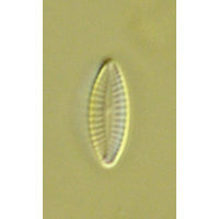 Achnanthidium subatomus