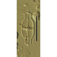 Achnanthidium exiguum