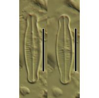 Achnanthidium microcephalum