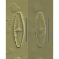 Achnanthidium minutissimum