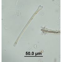 Actinella punctata