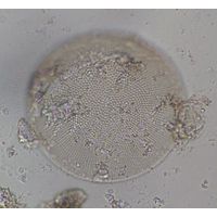 Actinocyclus