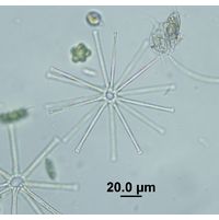 Asterionella formosa