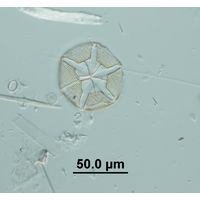 Asteromphalus robustus