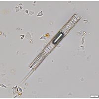 Aulacoseira granulata