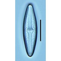 Brachysira brebissonii