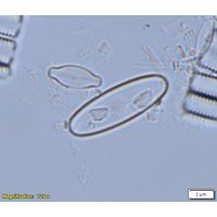 Cavinula variostriata
