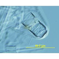 Chaetoceros concavicornis