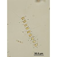 Chaetoceros sp.