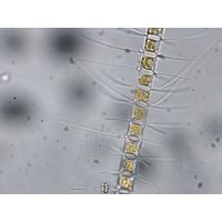 Chaetoceros sp.