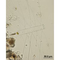 Chaetoceros sp. 