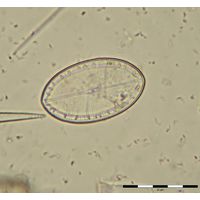 cocconeis-placentula-temelin