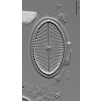 Cocconeis placentula