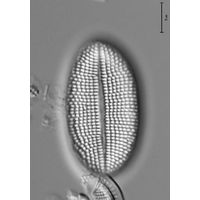 Cocconeis placentula