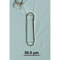 Corethron hystrix