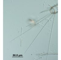 Corethron hystrix