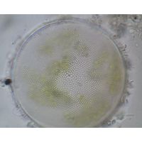 Coscinodiscus