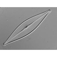 Craticula cuspidata