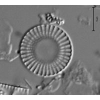 Cyclostephanos dubius