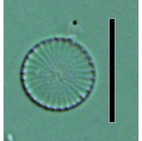 Cyclostephanos invisitatus