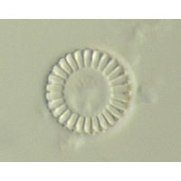Cyclotella meneghiniana