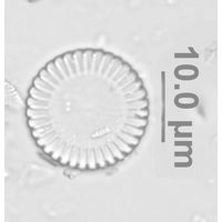 Cyclotella meneghiniana