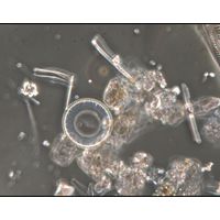 Cyclotella distinguenda