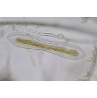 Cymatopleura solea
