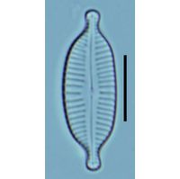 Cymbopleura amphicephala