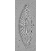 Cymbopleura inaequalis