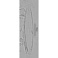 Cymbopleura incertiformis