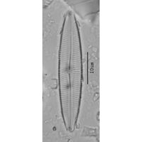 Cymbopleura incertiformis