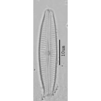 Cymbopleura subaequalis