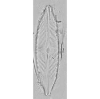 Cymbopleura tynii