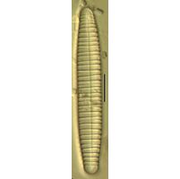 Diatoma vulgare