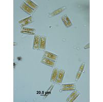 Diatoma vulgaris