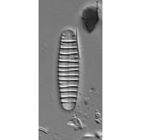 Diatoma  vulgaris