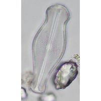 Didymosphenia geminata