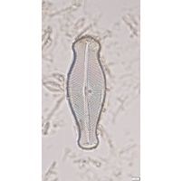 Didymosphenia geminata