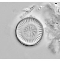 Discostella stelligera