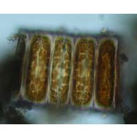 Ellerbeckia arenaria