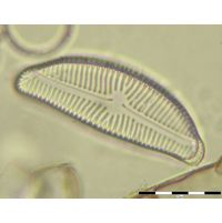 Encyonema