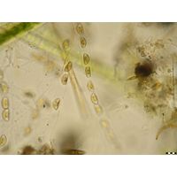 Encyonema