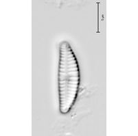 Encyonema perpusillum