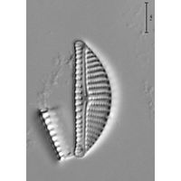 Encyonema ventricosum