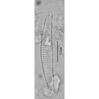 Encyonema