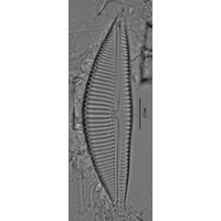 Encyonema elginense